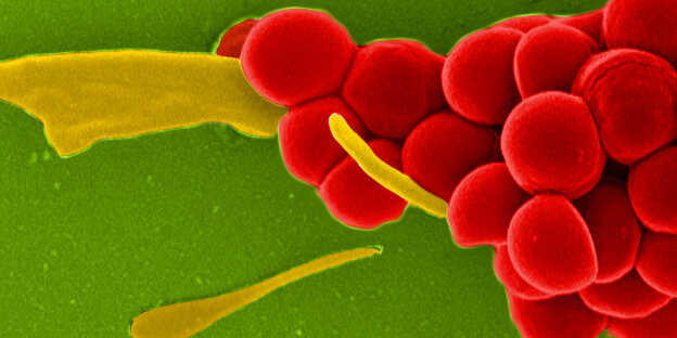 Rote Kügelchen aneinandergestreckt und gelbe Streifen auf einer grünen Fläche, Blick durchs Elektronenmikroskop