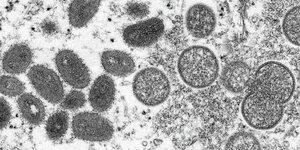 Diese elektronenmikroskopische Aufnahme aus dem Jahr 2003, die von den Centers for Disease Control and Prevention zur Verfügung gestellt wurde, zeigt reife, ovale Affenpockenvire