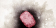 Elektronenmikroskopische Aufnahme von Affenpocken-Virus
