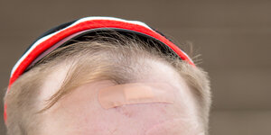 Ein Pflaster auf einer Stirn mit letzter blonder Locke, die dem Haarausfall bisher standgehalten hat.