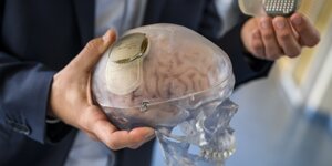 Eine Person hält das Modell eines Gehirns mit einem Chip in der Schädeldecke