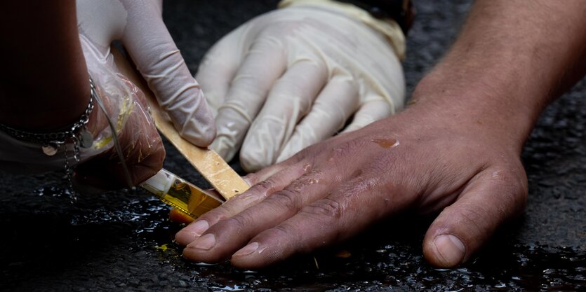 Eine festgeklebte Hand wird mit Öl und Spachtel von der Straße gelöst