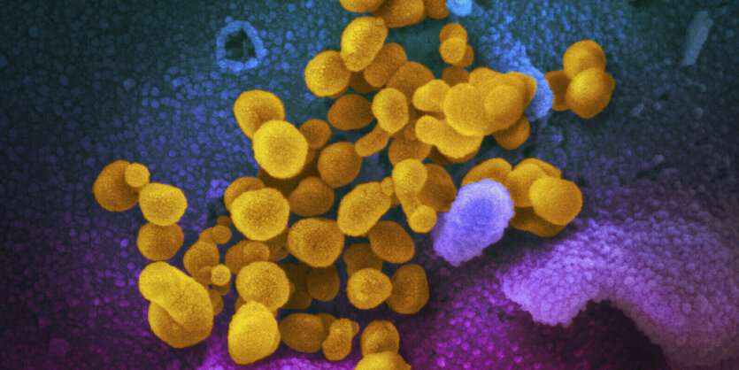 Kolorierte Elektronenmikroskopaufnahme des Coronavirus.