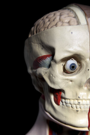 Der Kopf einer anatomischen Figur mit offener Schädeldecke