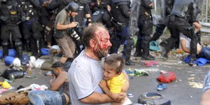 Ein Mann mit einer Platzwunde am Kopf trägt ein Kind auf dem Arm