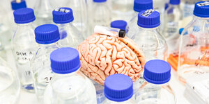Eine Ampulle mit Polysialinsäure liegt auf dem Modell eines Gehirns.