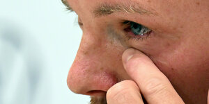 Nahaufnahme vom linken Auge von Julian Nagelsmann