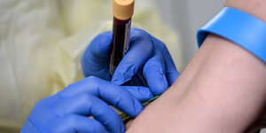 Eine Studienassistentin entnimmt eine Blutprobe bei einem Patienten.