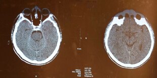 Aufnahmen eines Gehirnscans.