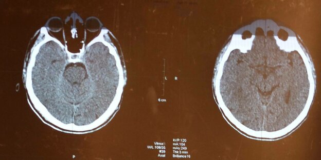 Aufnahmen eines Gehirnscans.