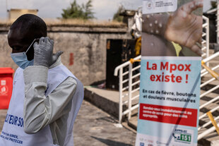 Mann in medizinischer Schutzausrüstung vor französischsprachigem Mpox-Plakat