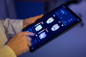 Eine Radiologin im Unfallkrankenhaus Berlin betrachtet in einer KI-basierten App auf einem Tablet Gehirnbilder eines Patienten.