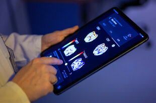 Eine Radiologin im Unfallkrankenhaus Berlin betrachtet in einer KI-basierten App auf einem Tablet Gehirnbilder eines Patienten.