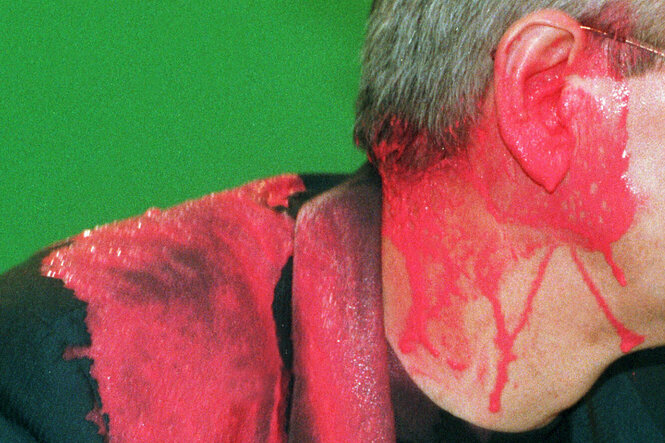 Das rote Ohr von Joschka Fischer, nachdem es von einem Farbbeutel getroffen wurde