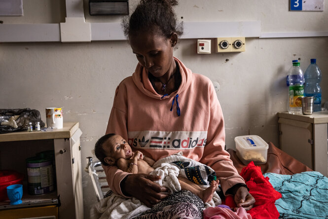 Eine Mutter hält ihre stark unterernährte kleine Tochter im Arm