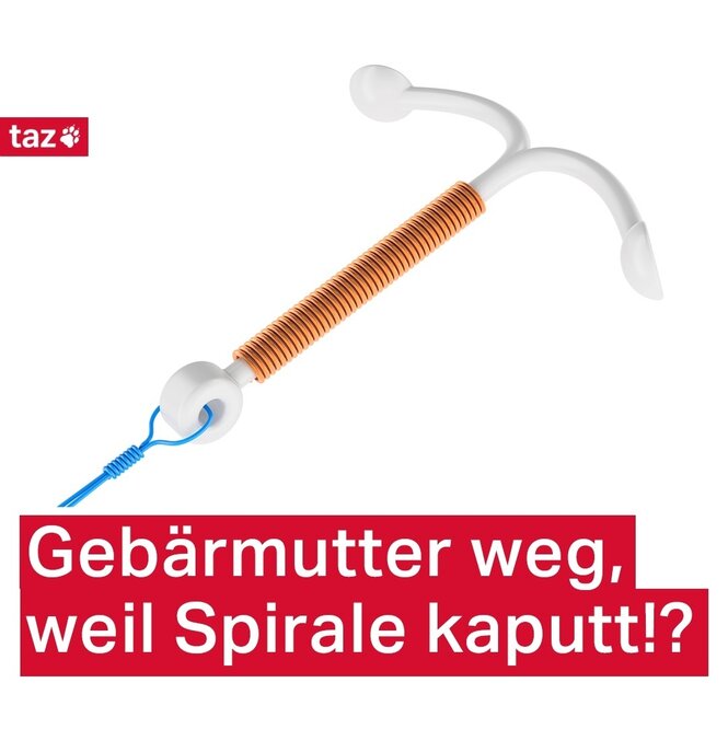 Gebärmutter weg, weil Spirale kaputt!?