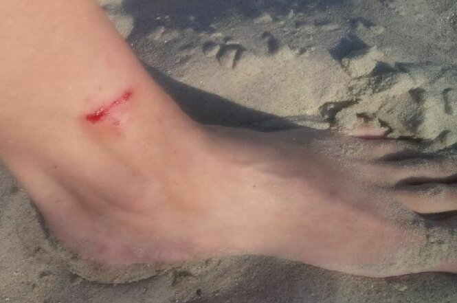 Fuß auf Sand mit Kratzer