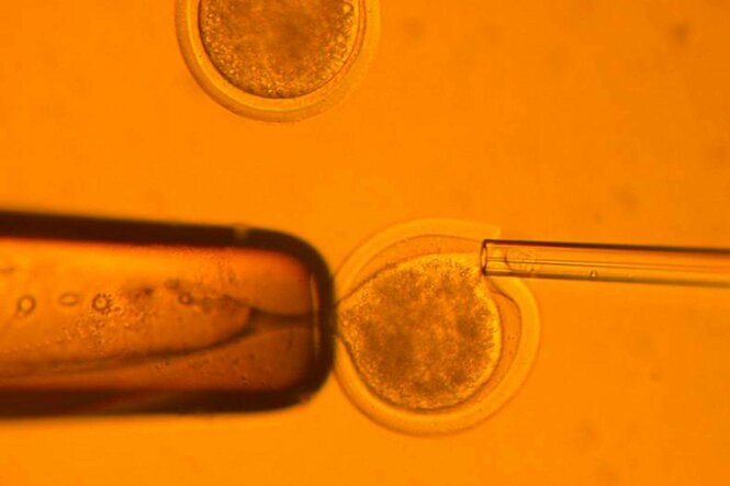 Mikroskopische Aufnahme der Injektion einer Körperzelle in eine Eizelle
