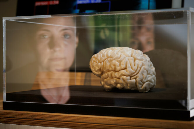 Ein Exponat (Nachbildung eines menschlichen Gehirns) in der Sonderausstellung «Künstliche Intelligenz. Die letzte Erfindung der Menschheit?».