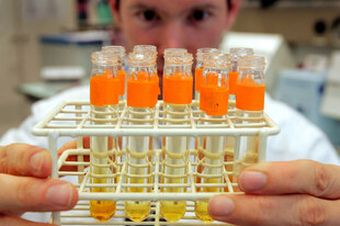 Ein Labormitarbeiter hält mehrere Urinrproben hoch