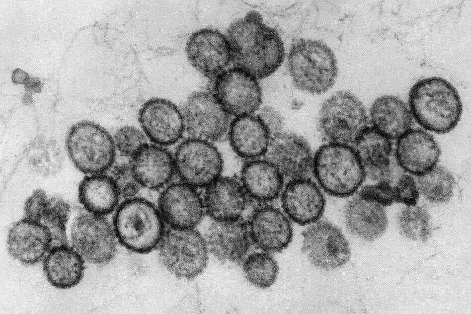 Hantaviren-Ausbruch: Ist das Hantavirus auch in Deutschland gefährlich?