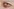 Ein verletztes Auge