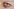Ein verletztes Auge