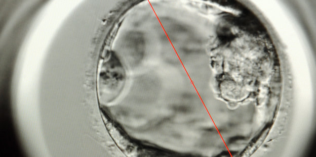 Ein Zellhaufen medininisch vergrößert im Kinderwunschzentrum leipzig