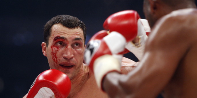 wladimir klitschko. Aber Wladimir Klitschko